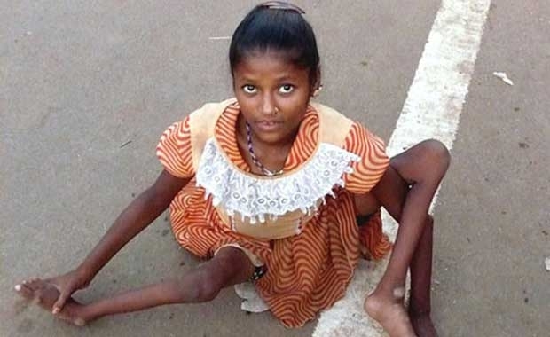 En ölümcül hastalıklar! galerisi resim 5