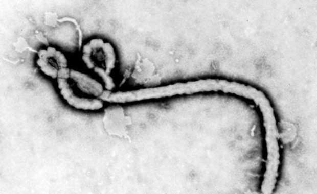 En ölümcül hastalıklar! galerisi resim 7