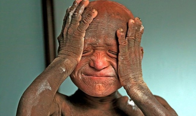 Günden güne taşa dönüşüyor galerisi resim 1