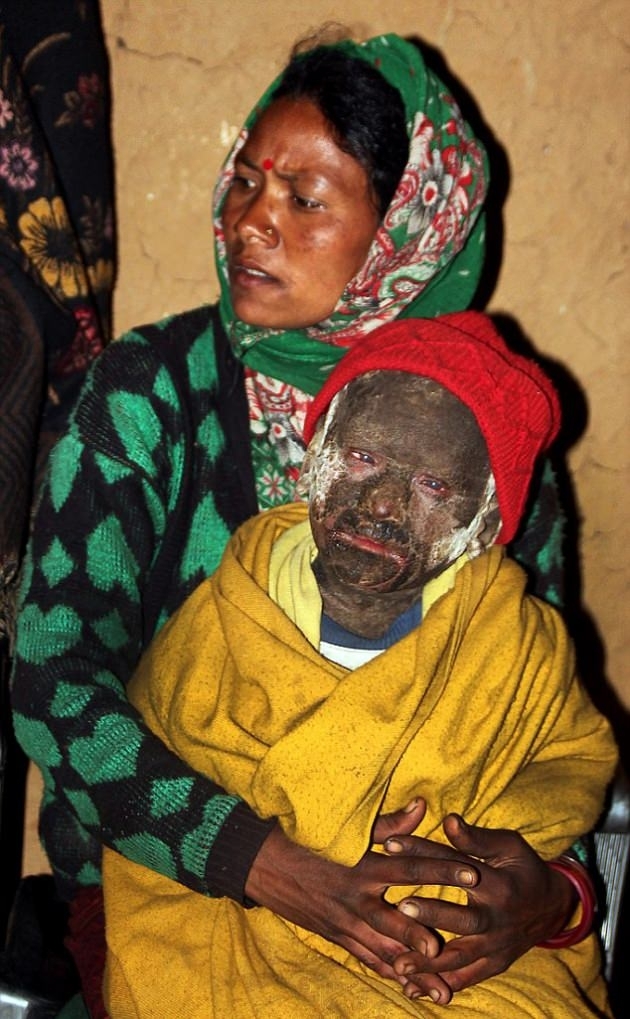 Günden güne taşa dönüşüyor galerisi resim 6