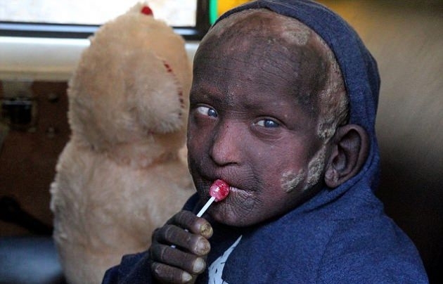 Günden güne taşa dönüşüyor galerisi resim 7