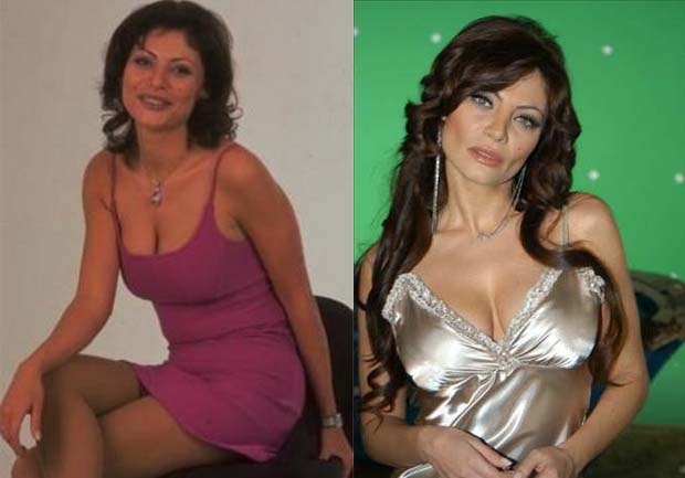 Yıllar Önce Yıllar Sonra... galerisi resim 23