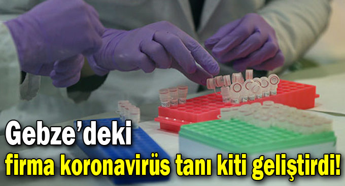 Gebze’deki firma koronavirüs tanı kiti geliştirdi!