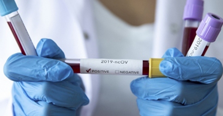 Bilim Kurulu'ndan umut veren uyarı