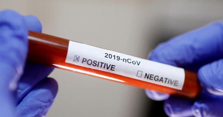 Koronavirüs salgınında gizli tehlike!