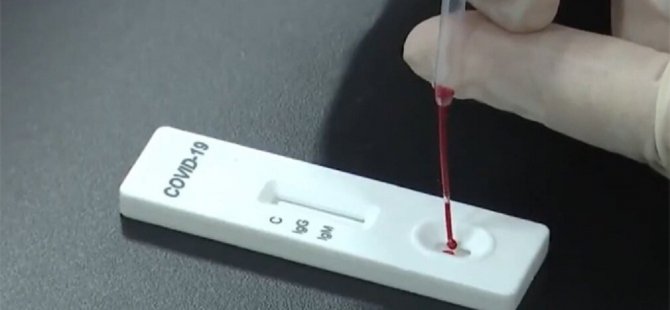 Koronavirüs testinde kriterler değişiyor!