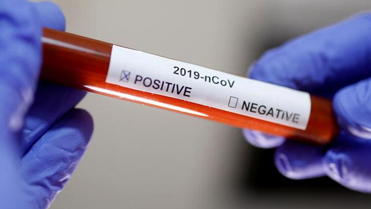 Kocaeli’de bu 3 ilçeye dikkat!