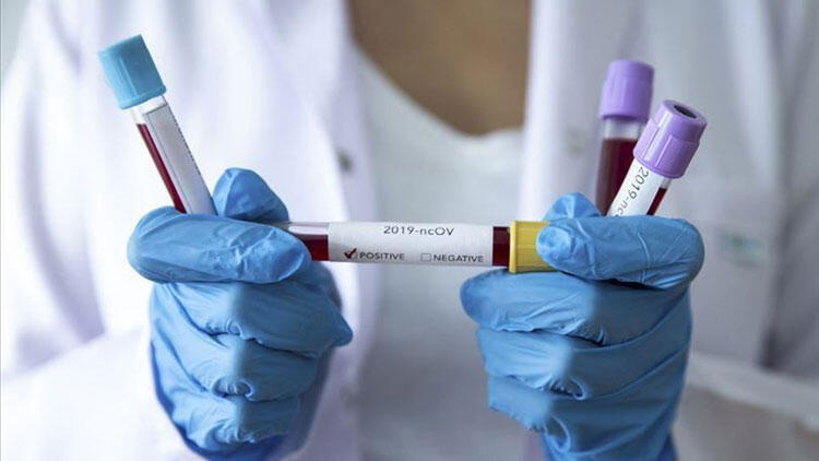 Belediye şirketinde müdürlerin testi pozitif çıktı!