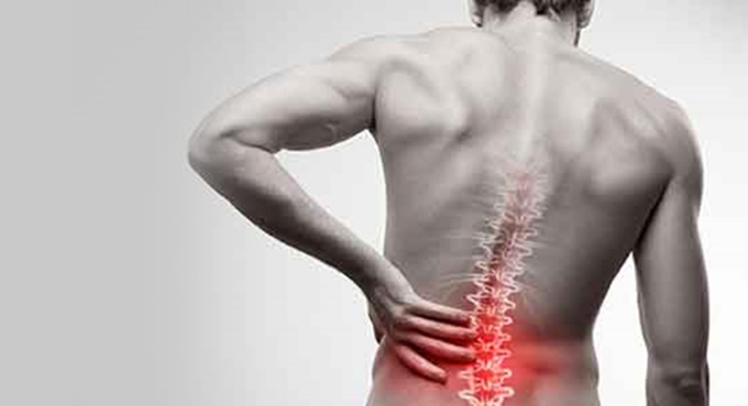 Her bel ağrısı fıtık belirtisi mi?