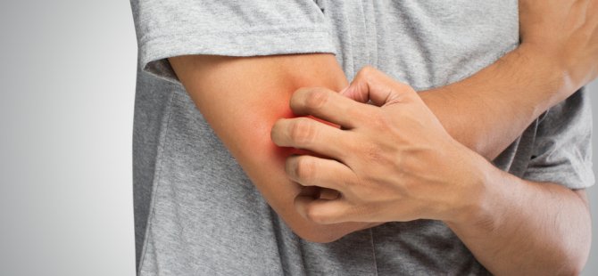 Mantar hastalığının en sık görülen belirtileri!