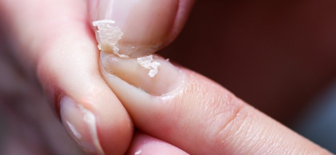 Tırnaklarımız sağlığımız hakkında önemli ipucu veriyor!