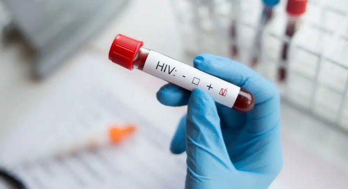 13 yaşındaki çocuk AIDS’ten öldü!