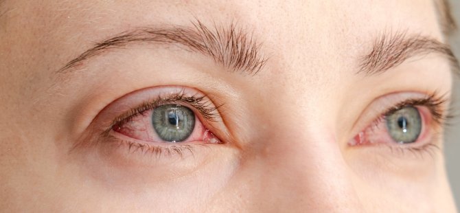 Türkiye’de ve Dünyada 50 Yaş Altı Körlüğün Birinci Nedeni: Diyabetik Retinopati