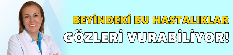BEYİNDEKİ BU HASTALIKLAR GÖZLERİ VURABİLİYOR!