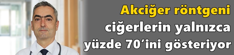 Akciğer röntgeni ciğerlerin yalnızca yüzde 70’ini gösteriyor