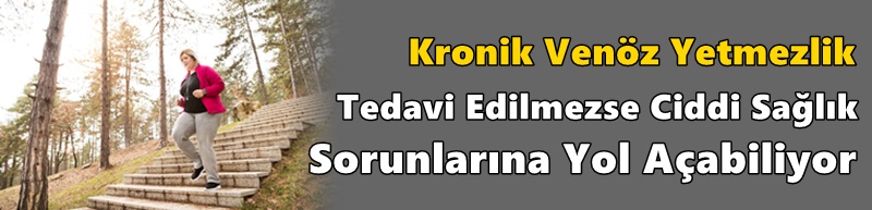 Kronik Venöz Yetmezlik Tedavi Edilmezse Ciddi Sağlık Sorunlarına Yol Açabiliyor