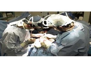Dünyanın Önde Gelen Beyin Cerrahları Antalya’ya Geliyor