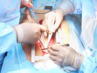 Kalp ameliyatlarında küçük kesi yönteminin 7 avantajı