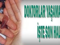 Doktorlar yaşamaz demişti. İşte son hali