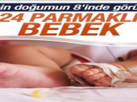 24 parmaklı bebek görenleri şaşırttı