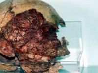 Müzedeki 7 Bin 200 Yıllık Kafatasına Büyük İlgi