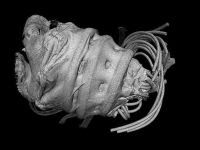 Kalp yetmezliği çeken hastalara müjde!