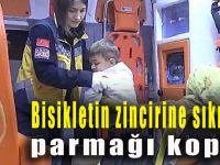 Bisikletin zincirine sıkışan parmağı koptu